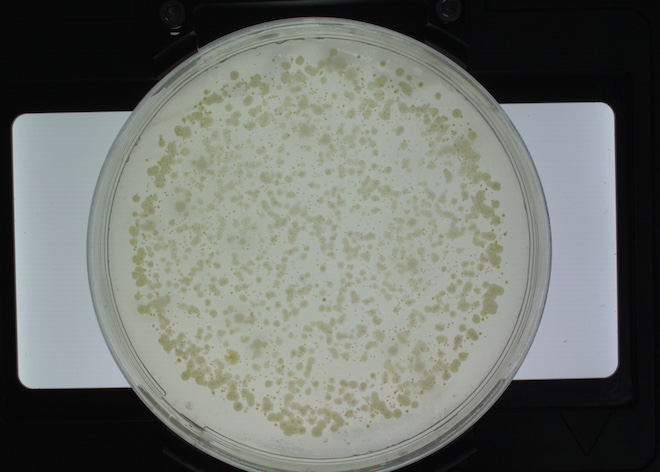 R2a agar test plate with bacteria visible after exposure from a water sample from a dental unit water line.